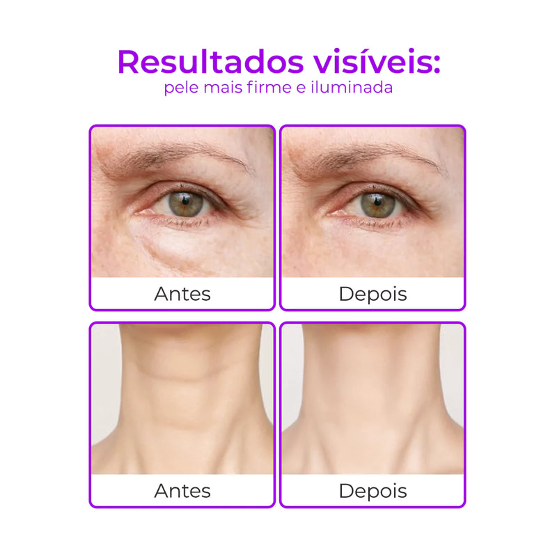 RejuMax - Combo Rejuvenescedor Para Pescoço e Olhos Que Firma e Suaviza Linhas Devolvendo Juventude à Pele